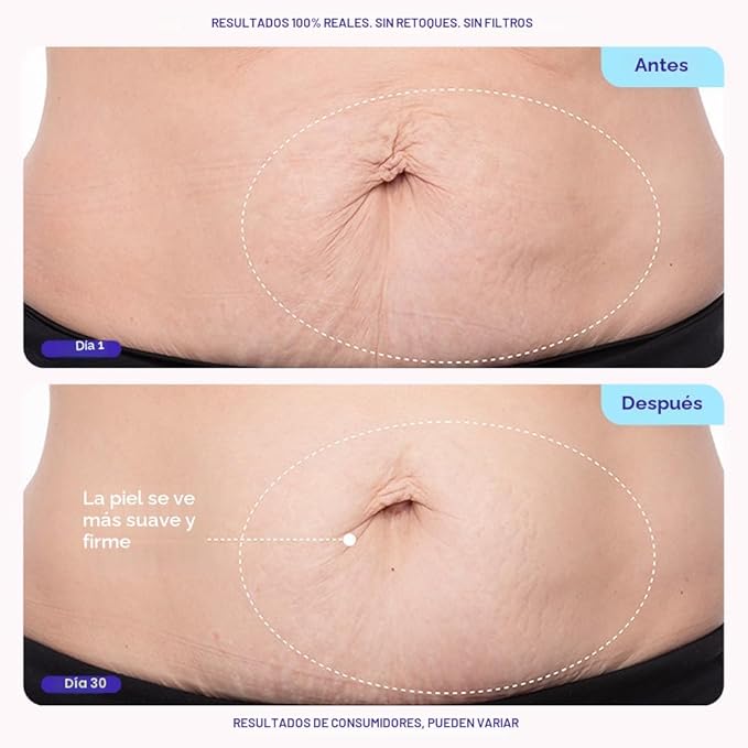 GoPure - Crema abdominal reductora de estrías y celulitis.