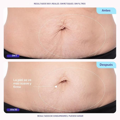 GoPure - Crema abdominal reductora de estrías y celulitis.