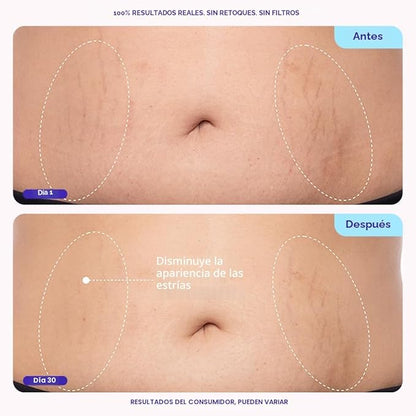 GoPure - Crema abdominal reductora de estrías y celulitis.